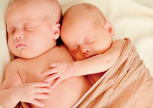 Гроб ражда сиамски близнаци